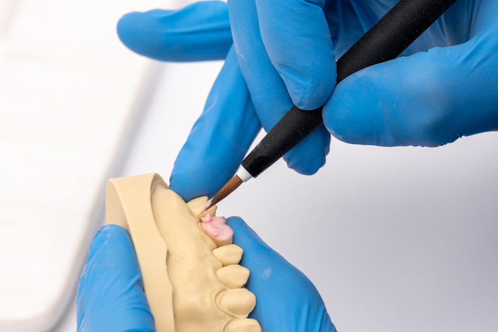 Dental technician using a brush with ceramic dental implants - Dental Bridge in Georgina, ON